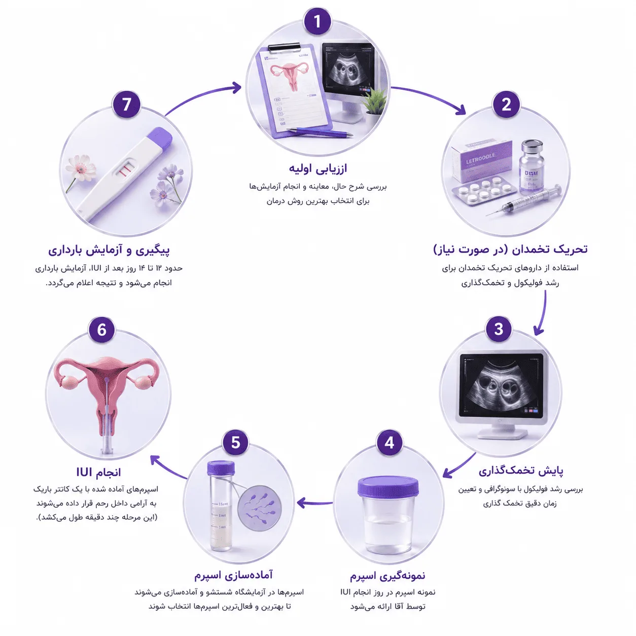 نمودار هفت مرحله‌ی تلقیح داخل رحمی
